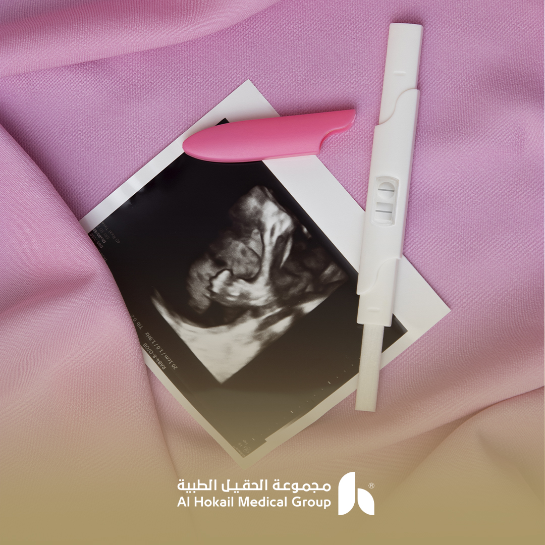 دكتورة ممتازة لتأخر الحمل