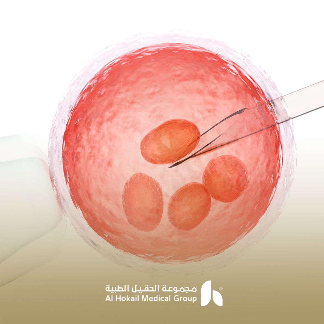 افضل دكتور حقن مجهري واطفال انابيب في الدمام