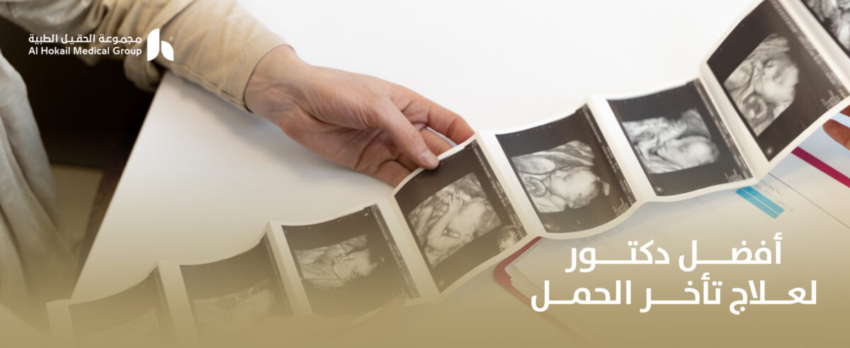 افضل-دكتور-لعلاج-تأخر-الحمل-1-1200x492.jpg