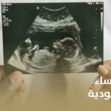 أشطر دكتورة نساء وتوليد في السعودية