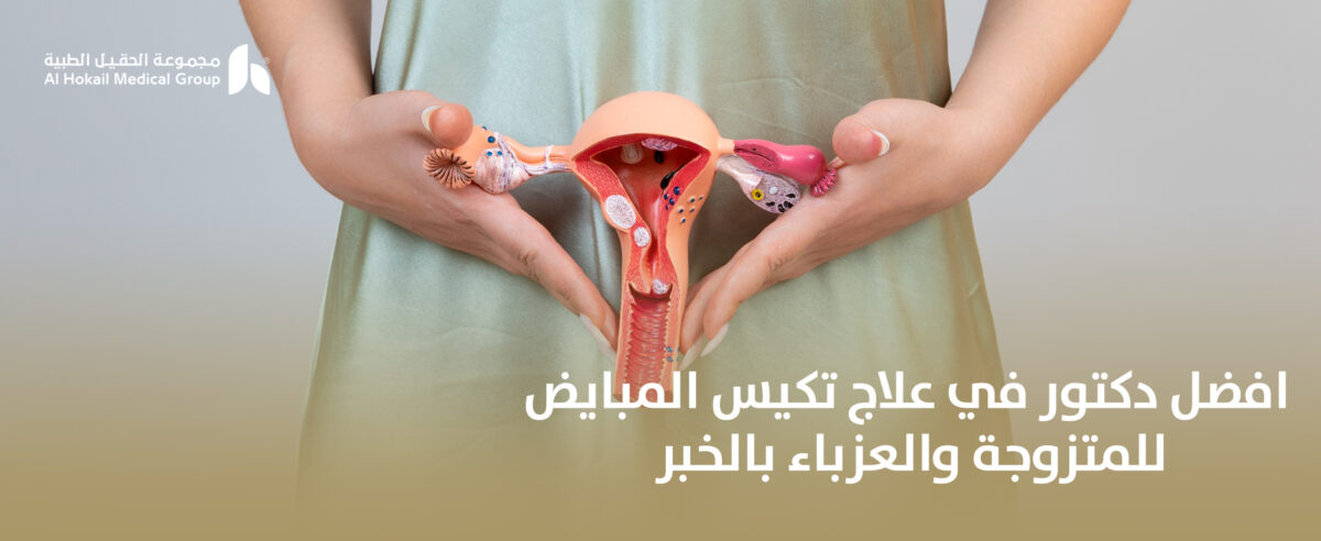 افضل-دكتور-في-علاج-تكيس-المبايض-للمتزوجة-والعزباء-بالخبر-1200x492.jpg