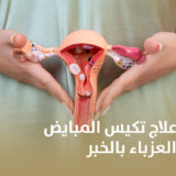 افضل دكتور في علاج تكيس المبايض للمتزوجة والعزباء بالخبر
