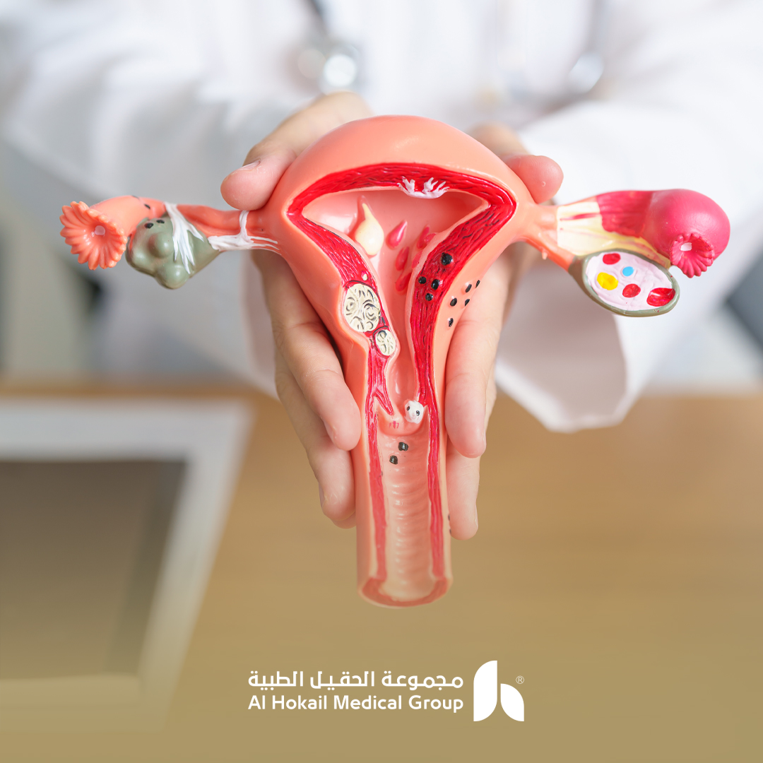 افضل دكتور في علاج تكيس المبايض للمتزوجة والعزباء بالخبر