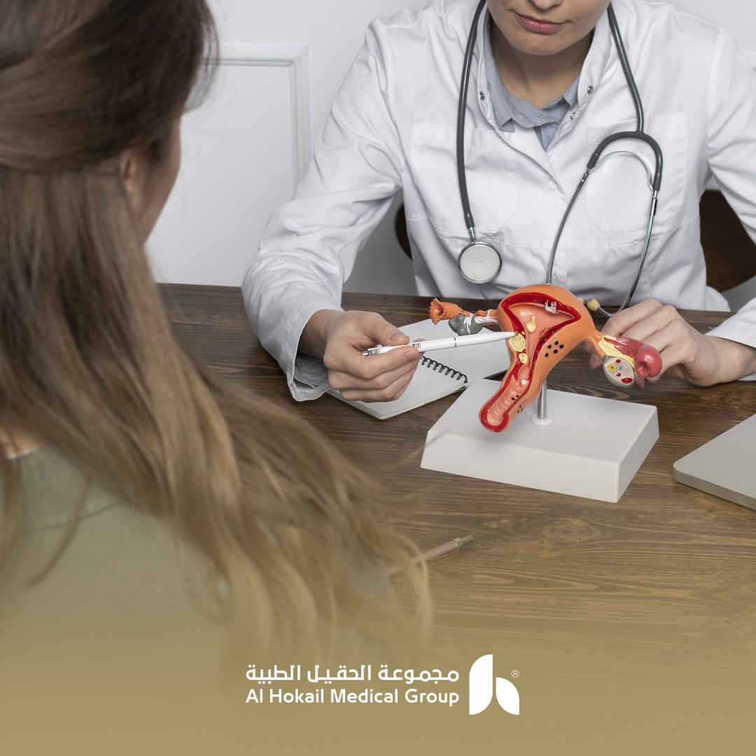 تجربتي الشخصية مع تكيس المبايض