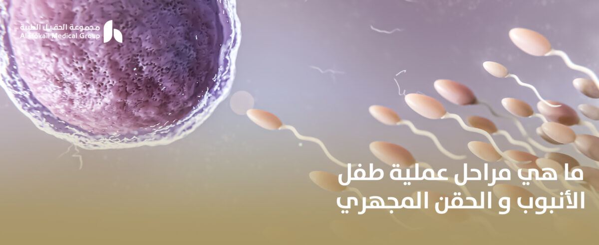 ما-هي-مراحل-عملية-طفل-الأنبوب-و-الحقن-المجهري-1200x492.jpg