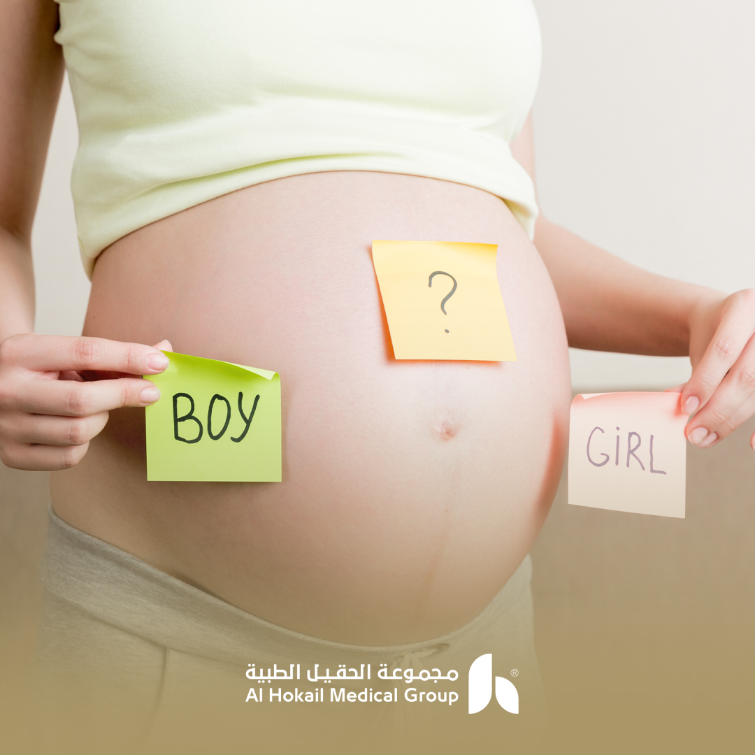 ترجيح جنس الجنين