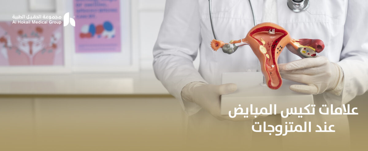 علامات-تكيس-المبايض-عند-المتزوجات-1200x492.jpg