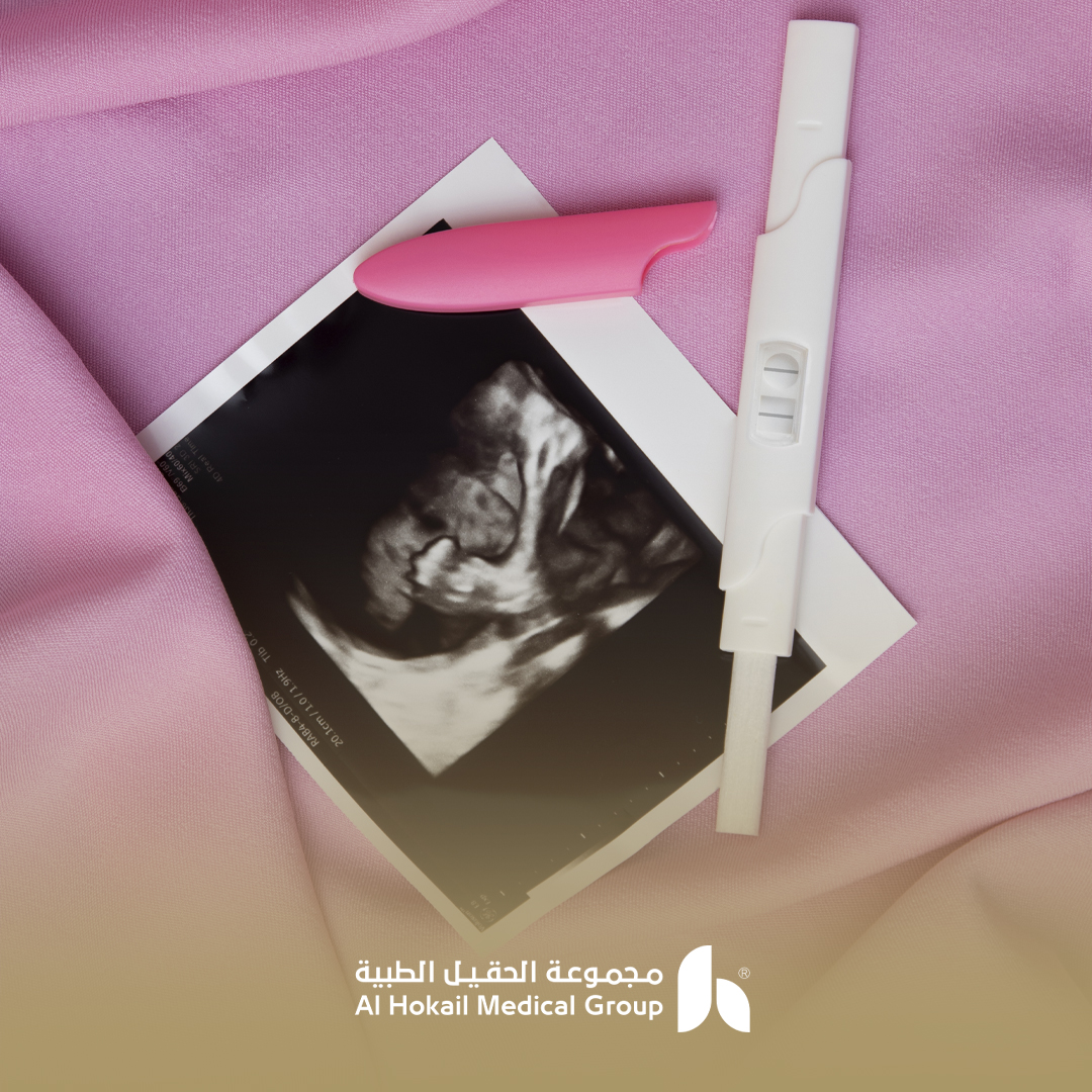 نسبة نجاح الحقن المجهري لزوجين سليمين محتوى