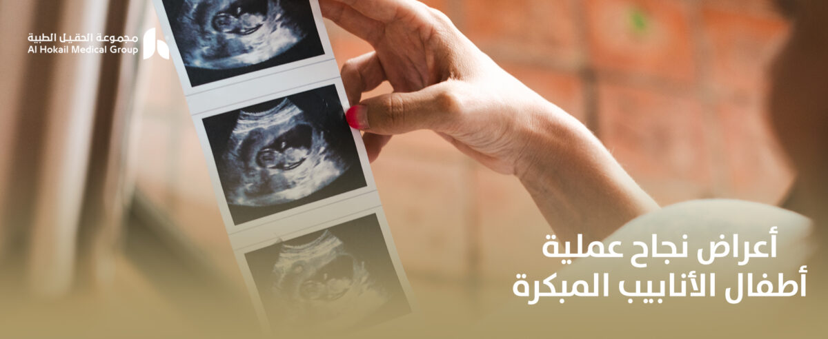 أعراض-نجاح-عملية-أطفال-الأنابيب-المبكرة-1200x492.jpg
