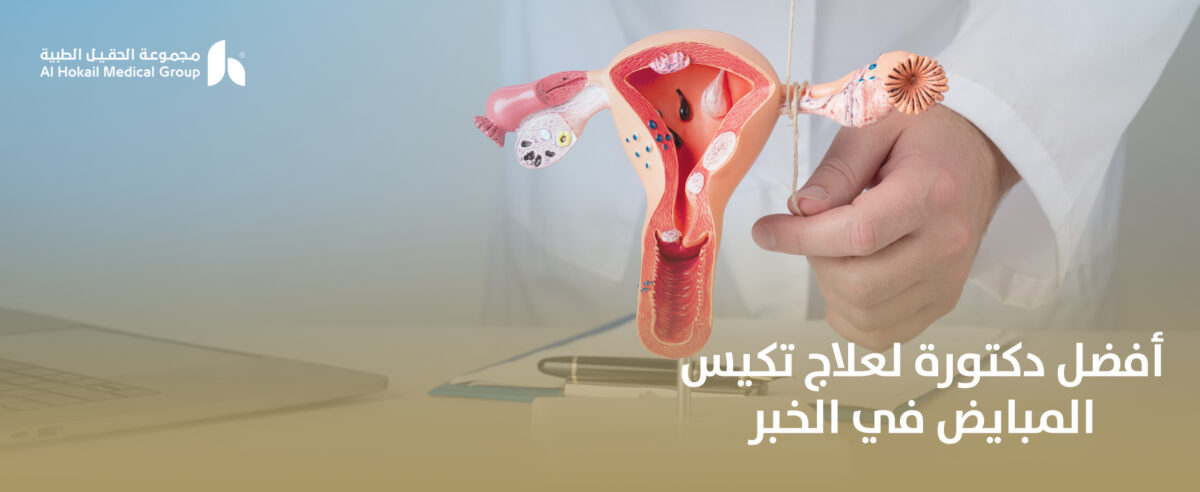 أفضل-دكتورة-لعلاج-تكيس-المبايض-في-الخبر-1200x492.jpg