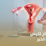 أفضل دكتورة لعلاج تكيس المبايض في الخبر
