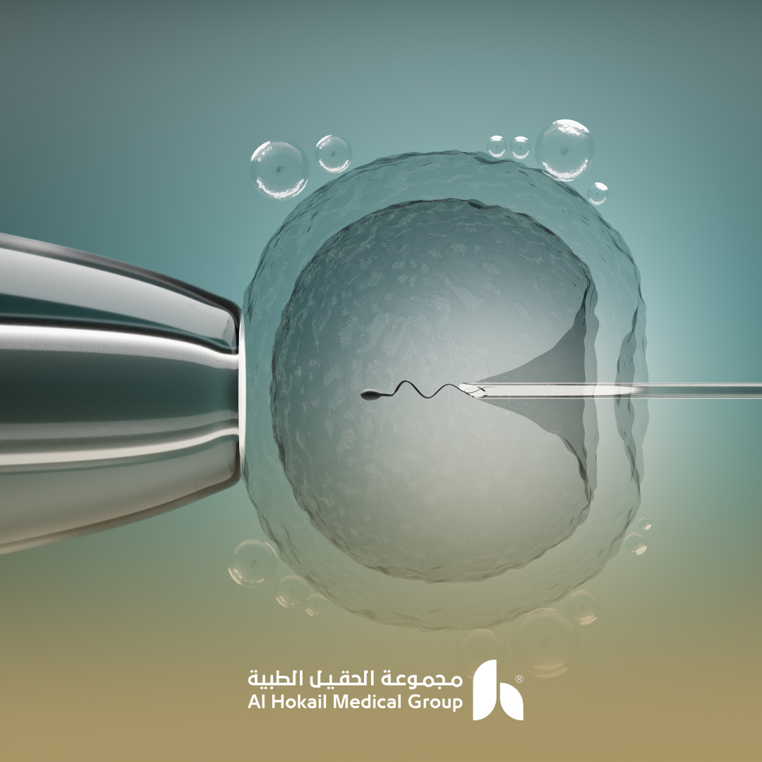 خطوات-عملية-الحقن-المجهري-بالتفصيل-محتوى.jpg