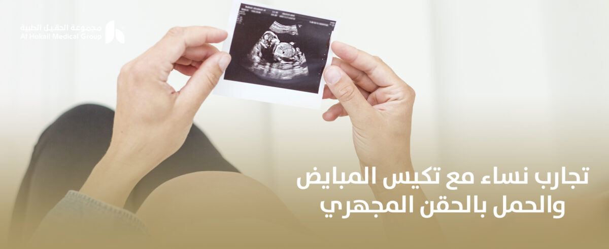 تجارب-نساء-مع-تكيس-المبايض-والحمل-بالحقن-المجهري-1200x492.jpg