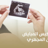تجارب نساء مع تكيس المبايض والحمل بالحقن المجهري