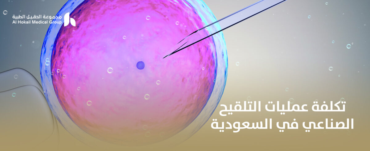 تكلفة-عمليات-التلقيح-الصناعي-في-السعودية-1200x492.jpg