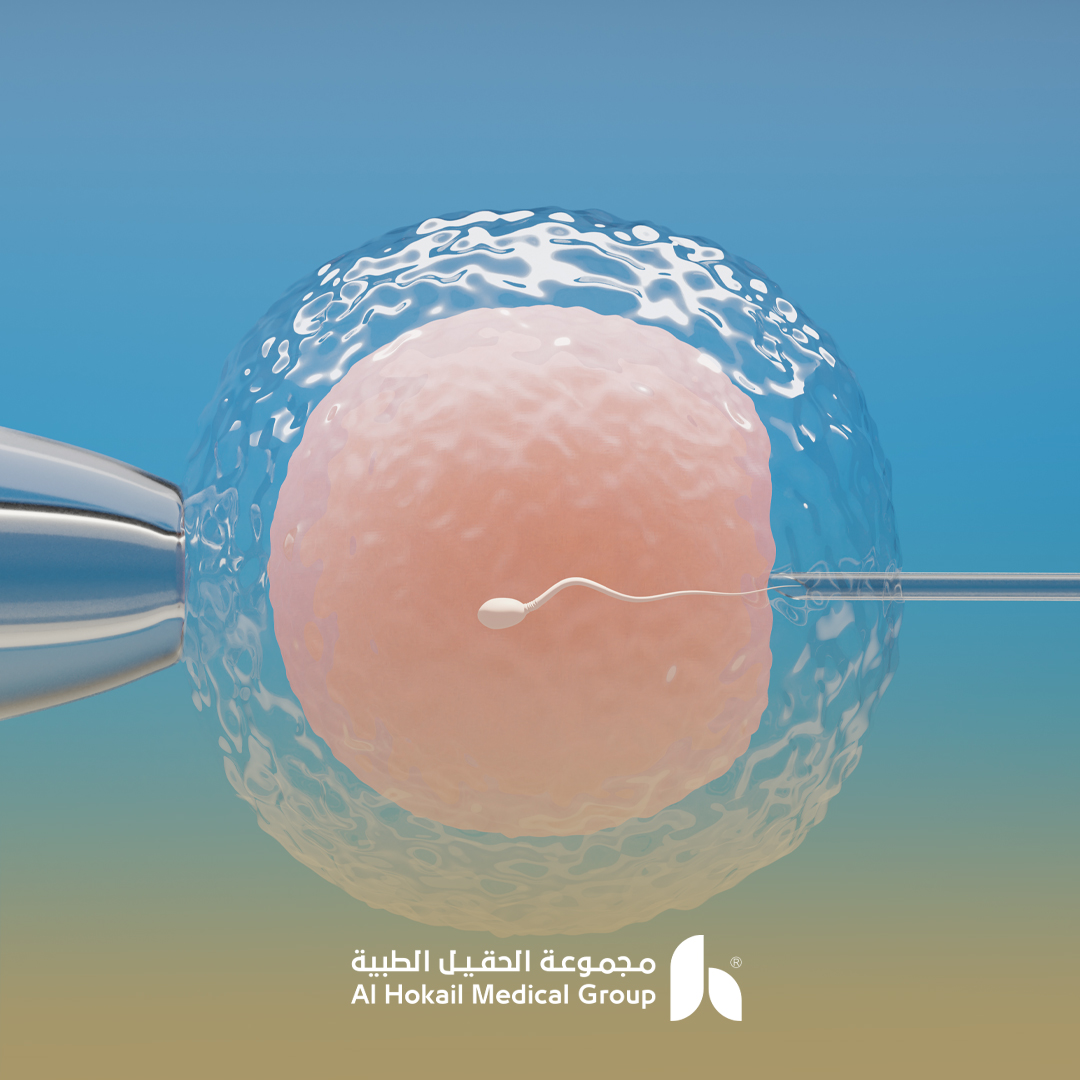 تكلفة عمليات التلقيح الصناعي في السعودية