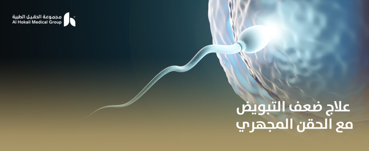 علاج-ضعف-التبويض-مع-الحقن-المجهري-1200x492.jpg