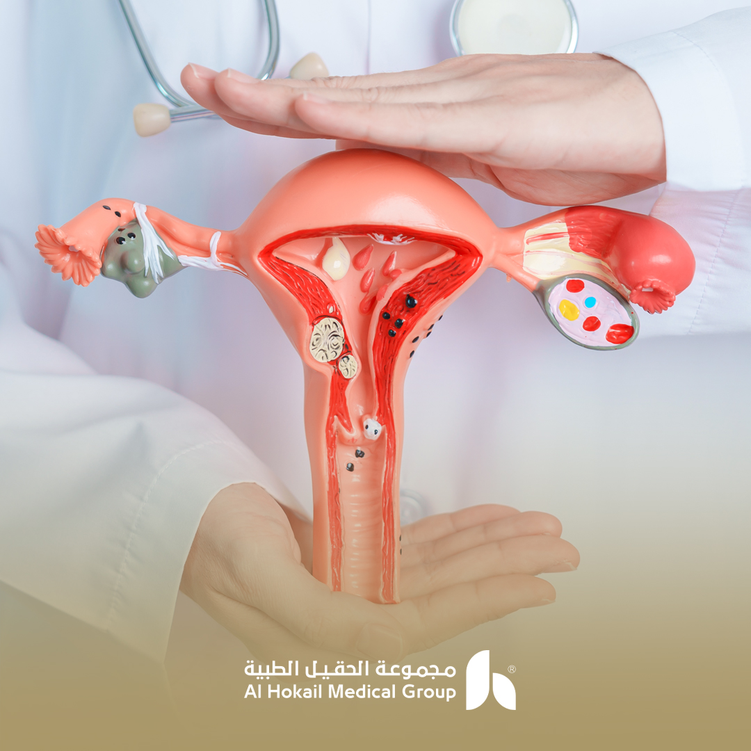 علاج ضعف المبايض بالأدوية والحقن