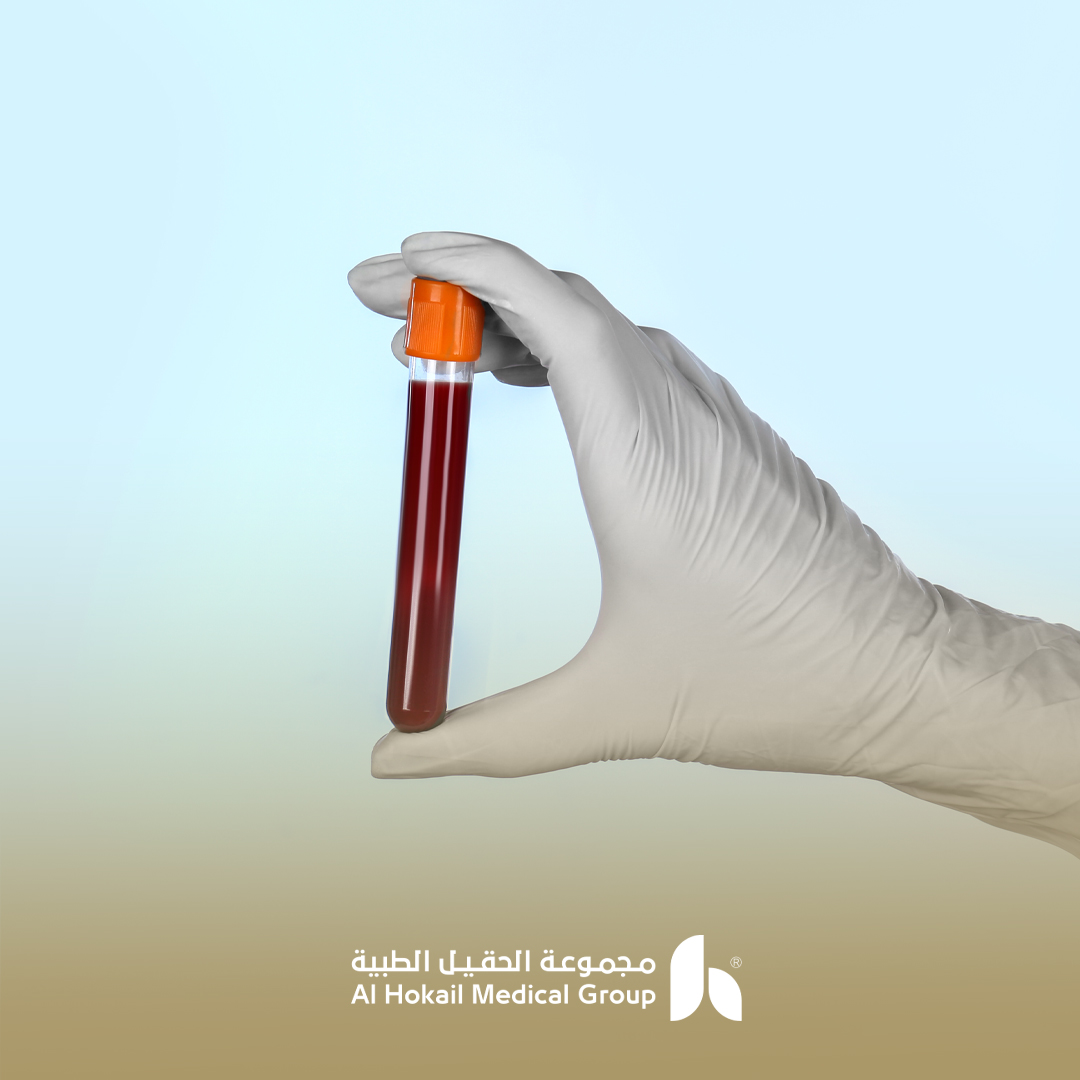 فحوصات الخصوبة للنساء والرجال