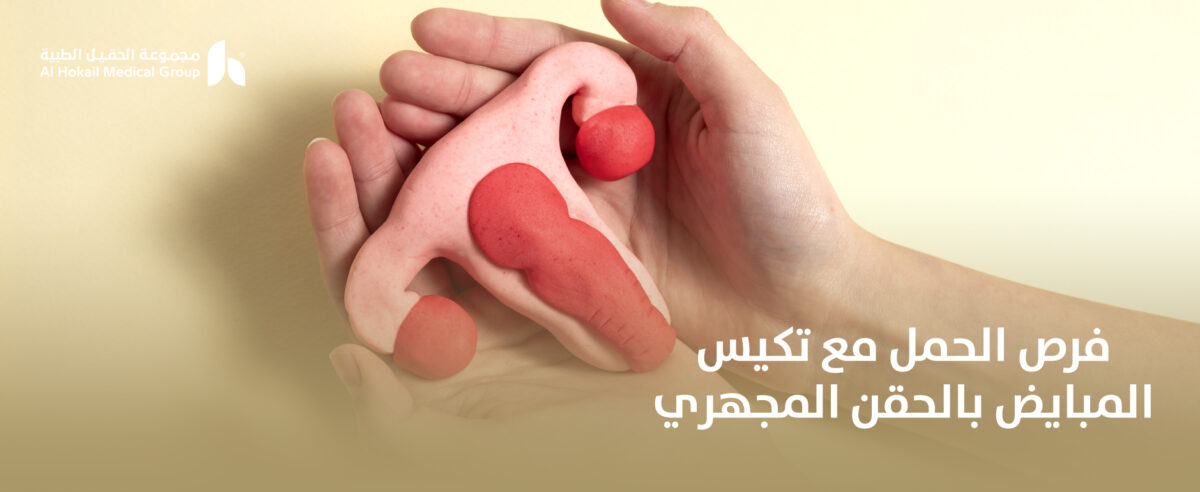 فرص-الحمل-مع-تكيس-المبايض-بالحقن-المجهري-1200x492.jpg
