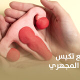 فرص الحمل مع تكيس المبايض بالحقن المجهري