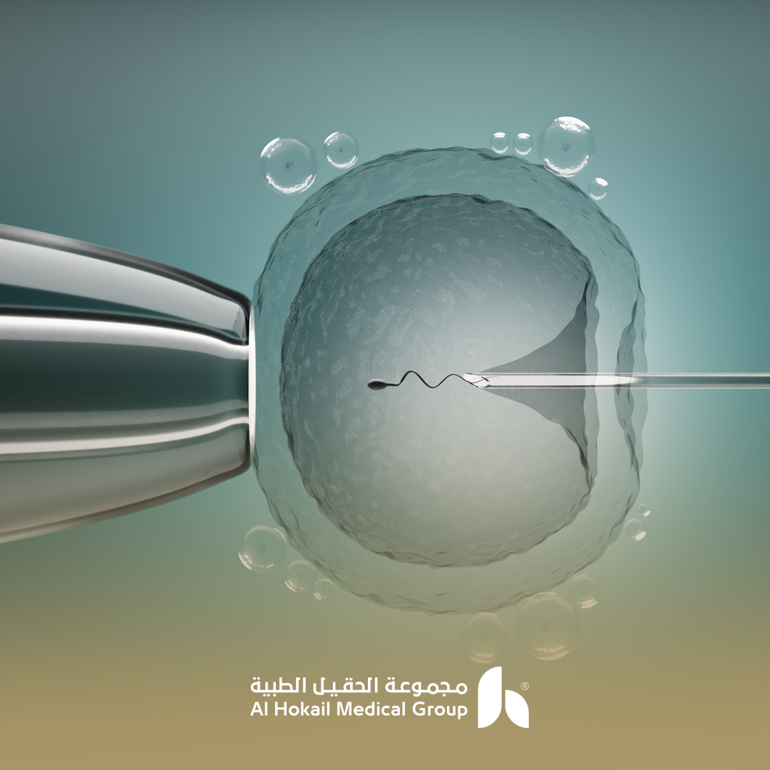 التلقيح الصناعي في الدمام