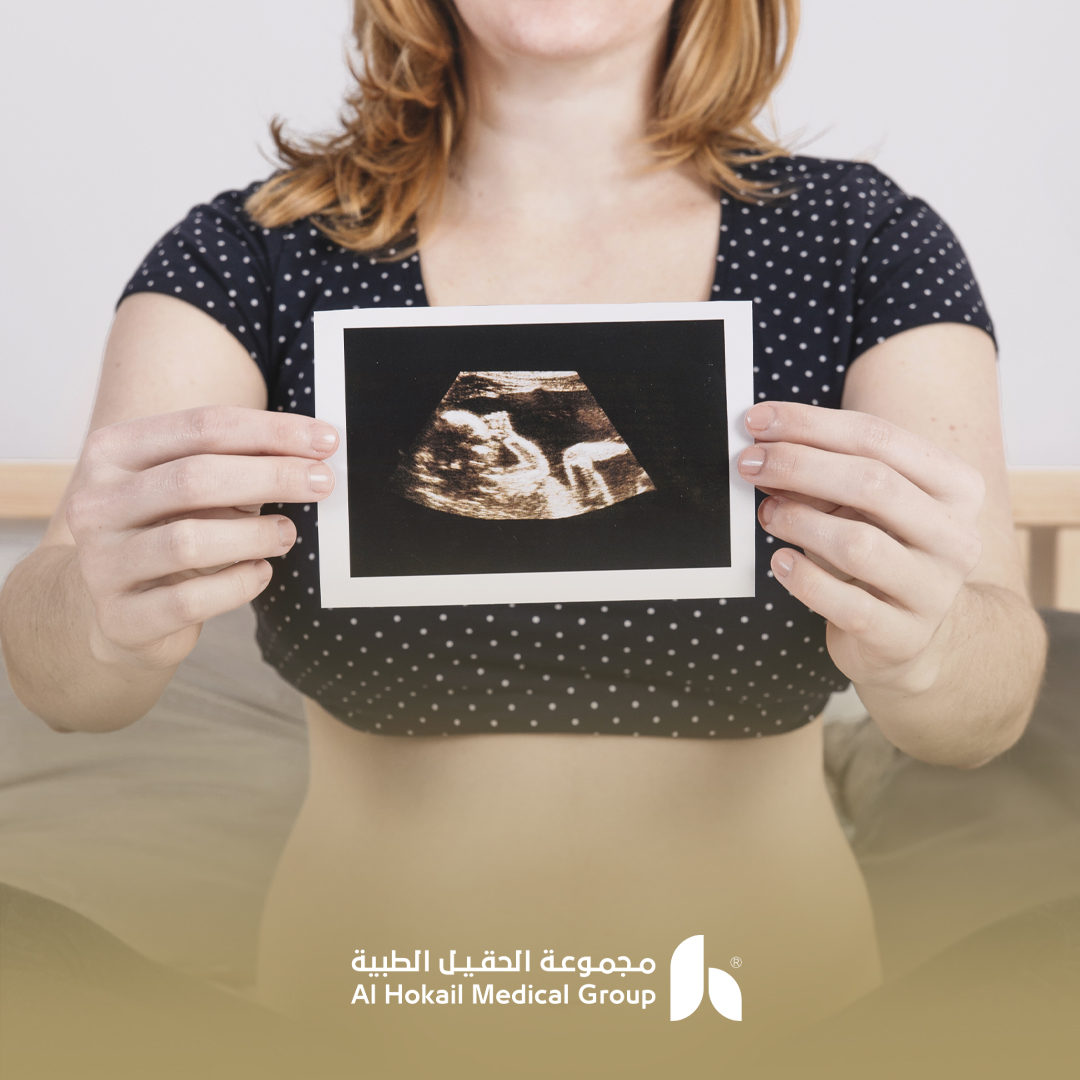 ما هو أفضل علاج لتأخر الحمل بدون حقن مجهري