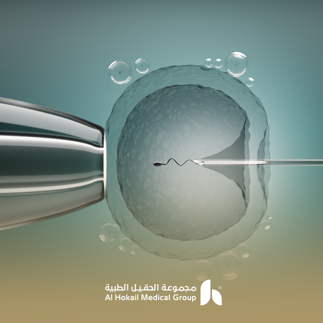 نصائح من د. سهام لزيادة فرص الحمل بعد التلقيح الصناعي