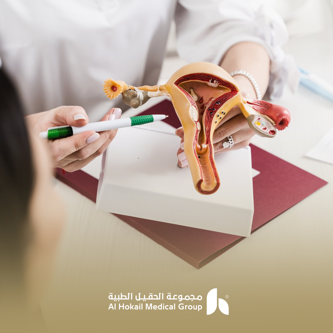 تشخيص أسباب العقم للنساء