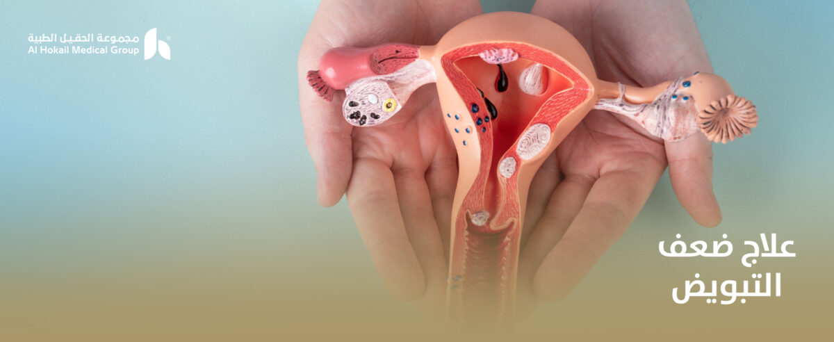علاج-ضعف-التبويض-1200x492.jpg
