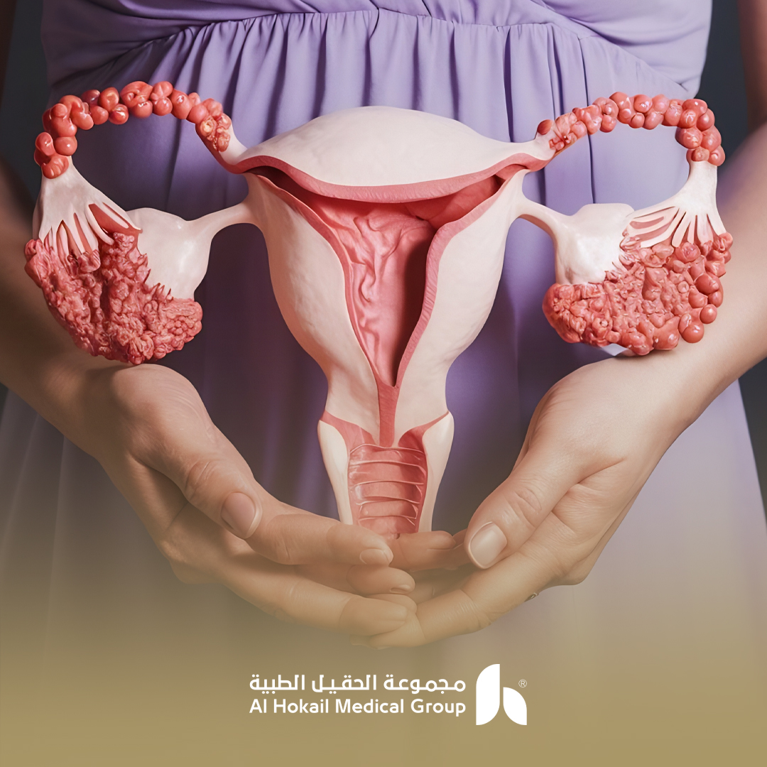 علاج ضعف التبويض