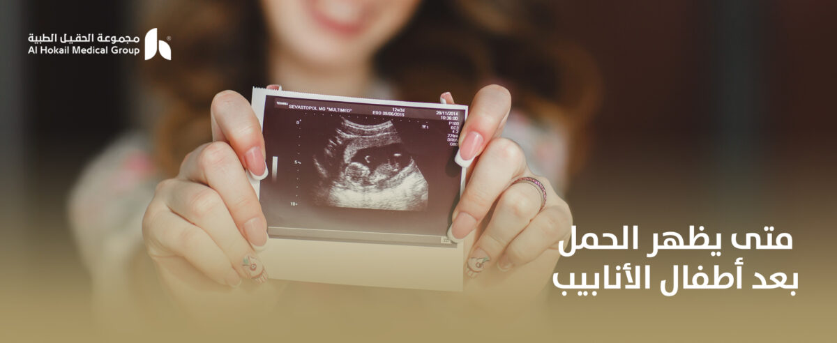 متى-يظهر-الحمل-بعد-أطفال-الأنابيب-1200x492.jpg