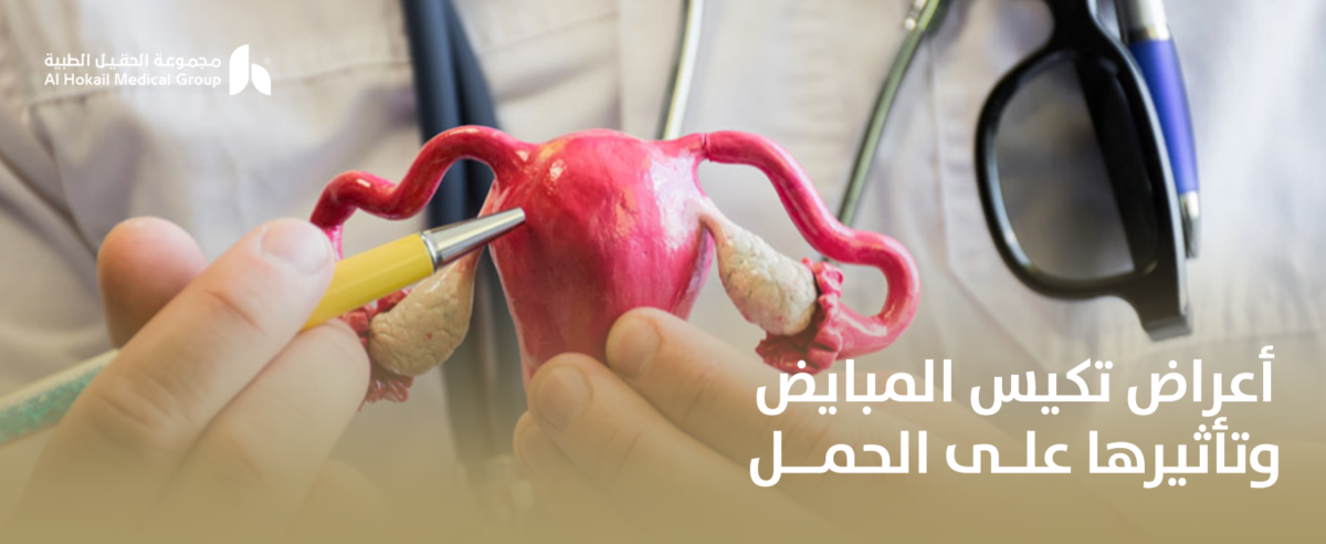 أعراض-تكيس-المبايض-وتأثيرها-على-الحمل-1200x492.png