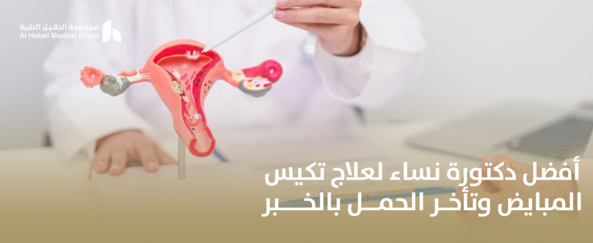 أفضل-دكتورة-نساء-لعلاج-تكيس-المبايض-وتأخر-الحمل-بالخبر-1200x492.png