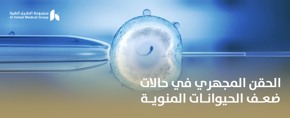 الحقن-المجهري-في-حالات-ضعف-الحيوانات-المنوية-1-1200x492.png