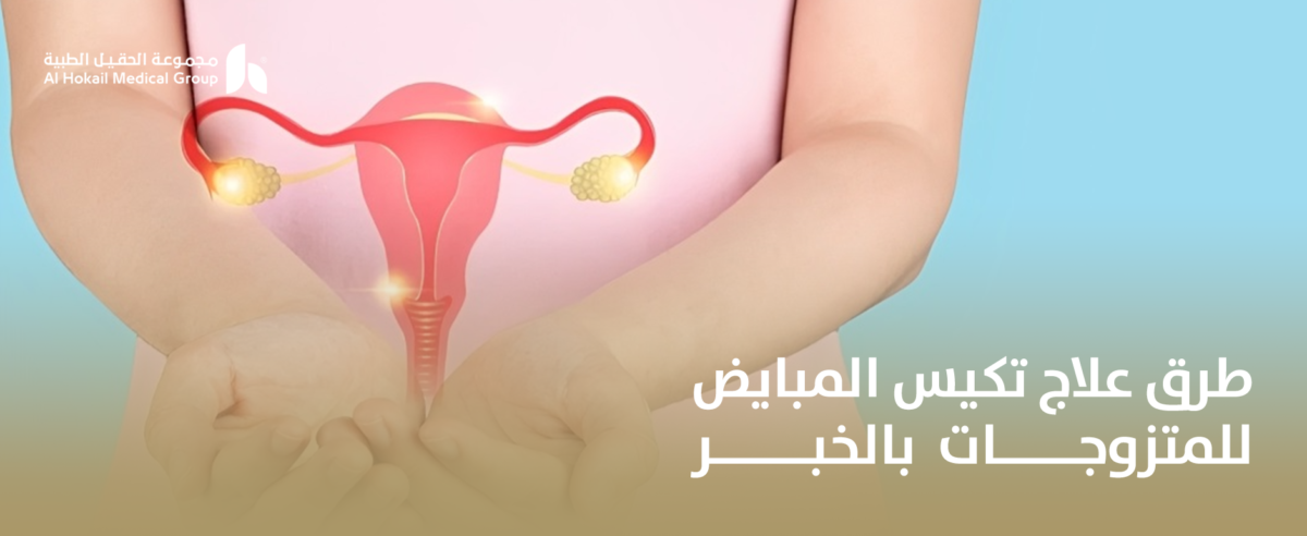 طرق-علاج-تكيس-المبايض-للمتزوجات-بالخبر-1200x492.png