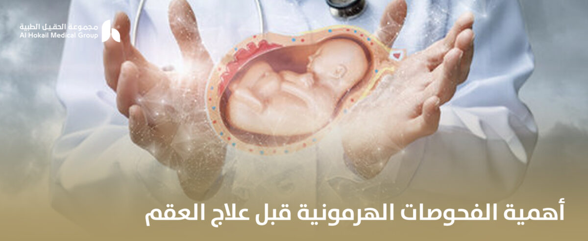 أهمية-الفحوصات-الهرمونية-قبل-علاج-العقم-1200x492.jpg