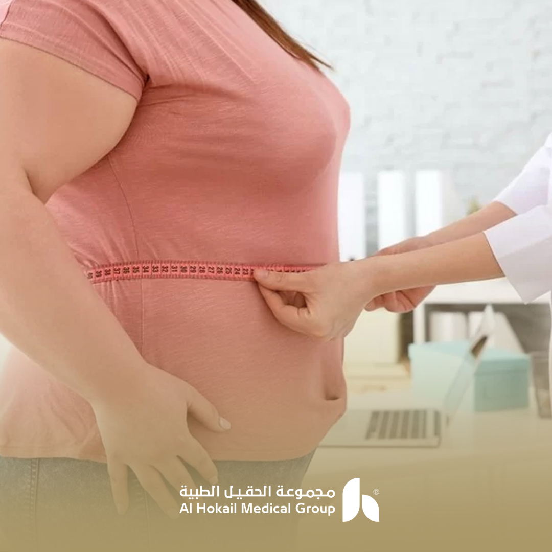 العلاقة بين زيادة الوزن والعقم
