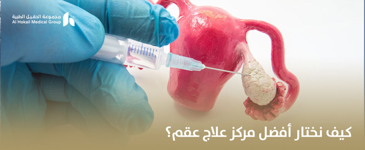 كيف-نختار-أفضل-مركز-علاج-عقم؟-1200x492.jpg