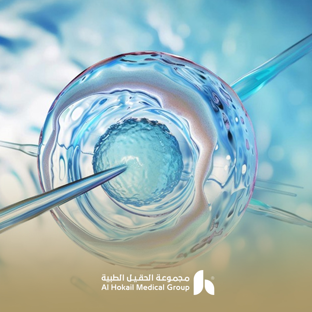 علاج العقم بأساليب طبية حديثة