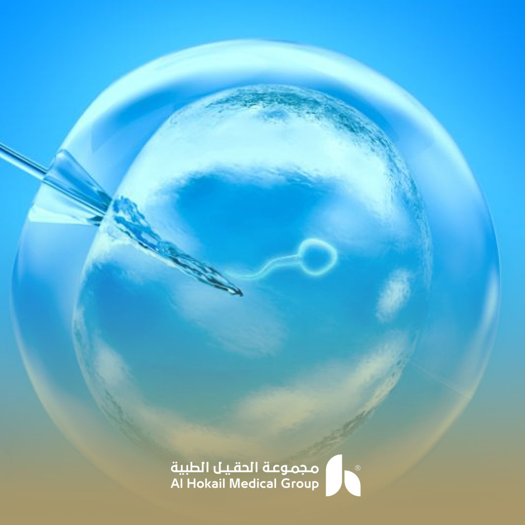 الحقن المجهري وتجارب الحمل المتعدد وكيفية رعاية التوأم 1 الحقن المجهري وتجارب الحمل المتعدد