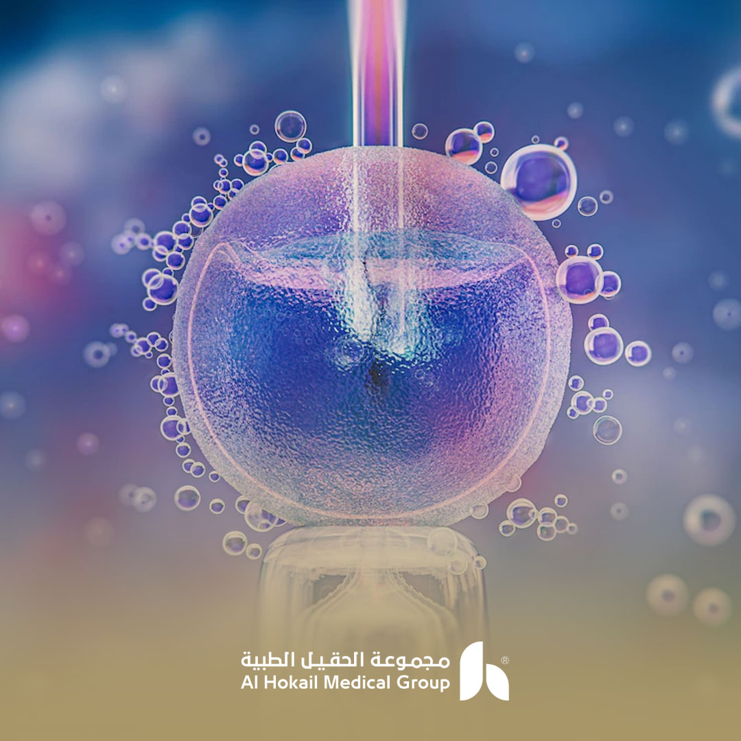 حلول العقم بأحدث تقنيات الحقن المجهري 1 حلول العقم بأحدث تقنيات الحقن المجهري