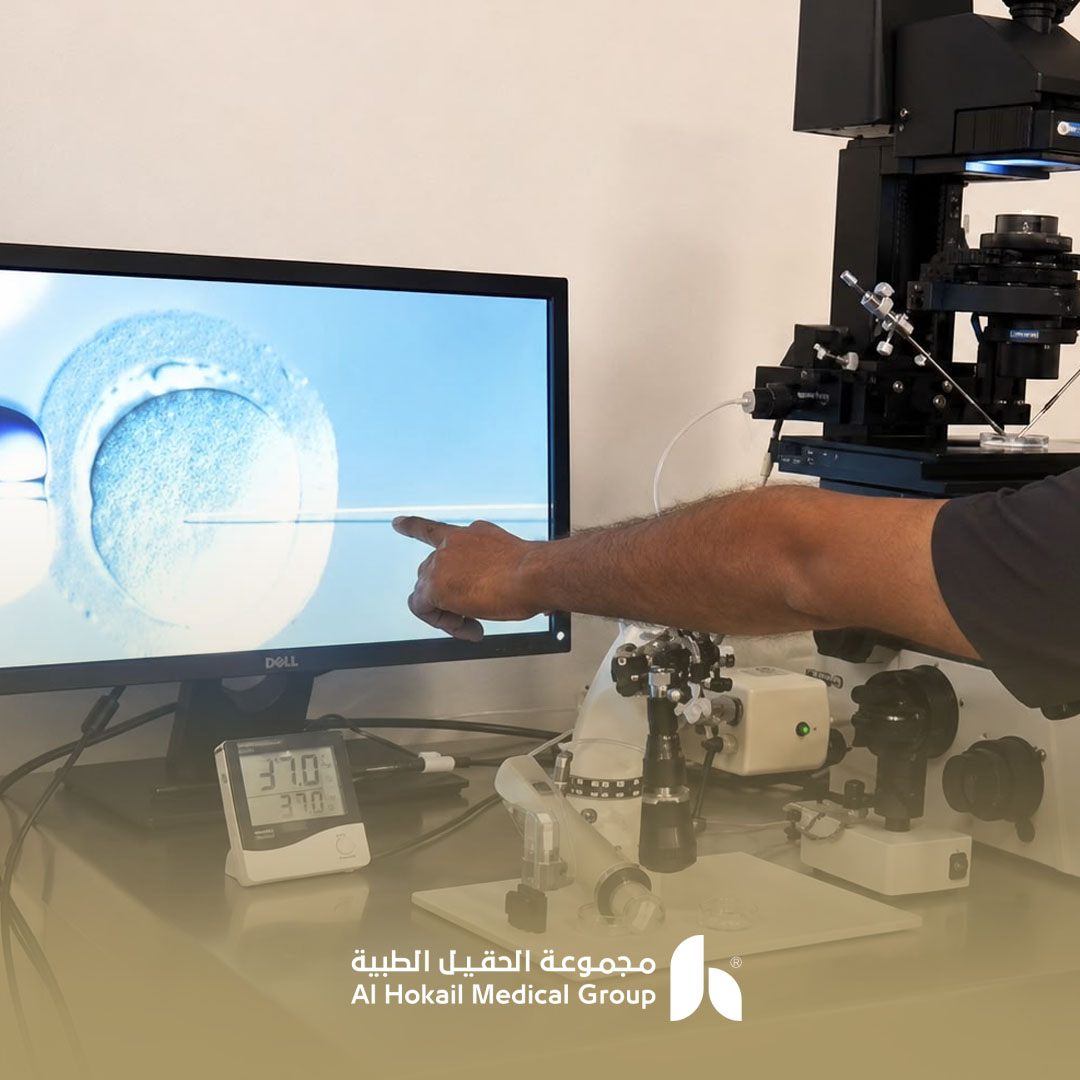 علاج العقم باستخدام أحدث التقنيات 1 علاج العقم باستخدام أحدث التقنيات