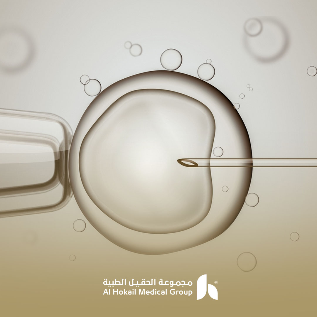 فرص نجاح عالية مع الحقن المجهري