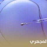 متى نكرر الحقن المجهري