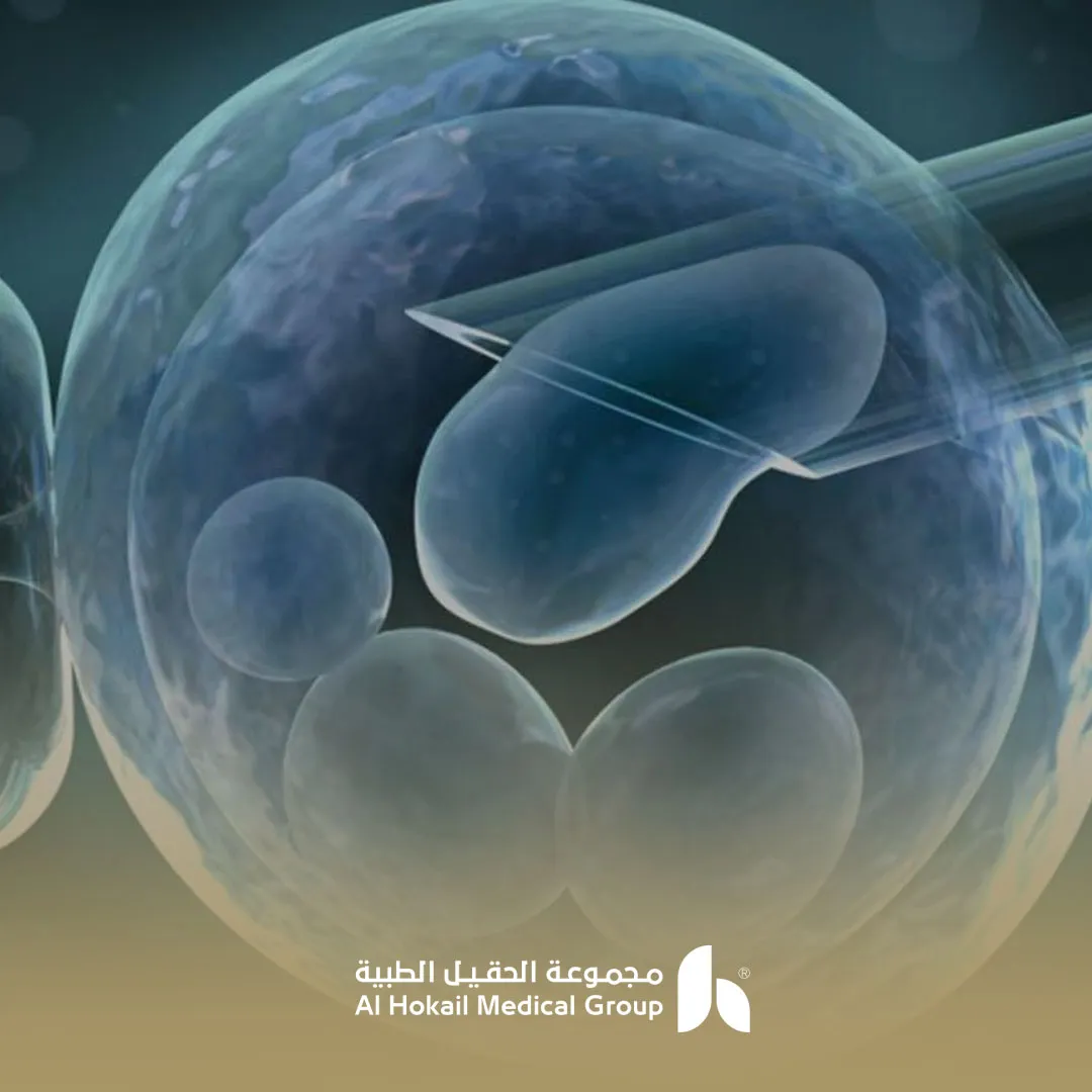 تلقيح البويضة الاصطناعي