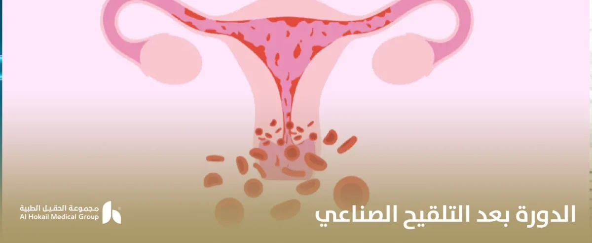 الدورة-بعد-التلقيح-الصناعي-1200x492.webp