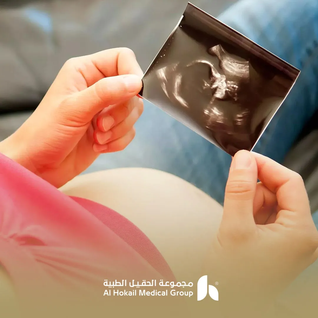 تحديد نوع الجنين في اي اسبوع (2)