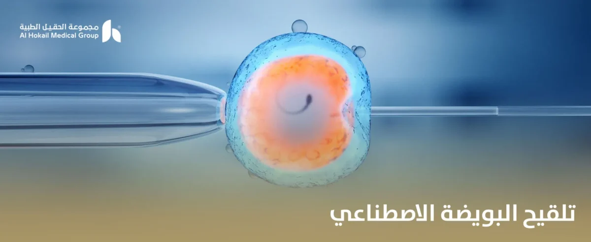 تلقيح-البويضة-الاصطناعي-1200x492.webp