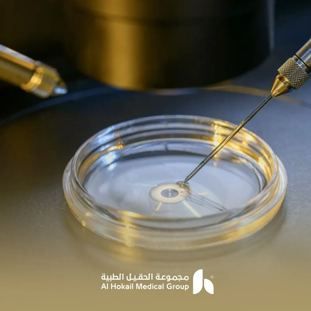 أفضل مراكز الحقن المجهري في السعودية